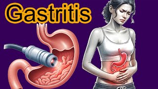 5 Early signs of Gastritis Gastritis diagnosis and treatment [upl. by Cowie]