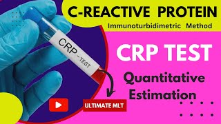 CRP CREACTIVE PROTEIN  QUANTITATIVE ESTIMATION OF CRP  IMMUNOTURBIDIMETRY [upl. by Euk]