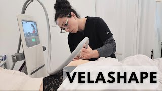 Shape Up with VelaShape III Your Ultimate Guide to Body Contouring [upl. by Philana830]