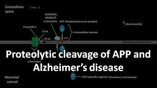 Alzheimers disease [upl. by Naugan]