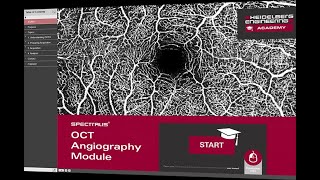 Webinar SPECTRALIS  Módulo de angiografía OCT  Heidelberg Engineering [upl. by Akeret52]