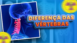 APRENDA AS DIFERENÇAS DAS VÉRTEBRAS  Radiologando [upl. by Gerbold]