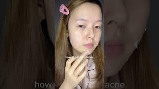 if you have acne you need to try this viral japanese ✨Lion Pair Acne Treatment✨ skincare acne [upl. by Ewolram]