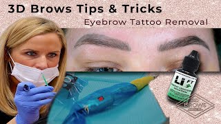 Eyebrow Tattoo Removal using Saline solution [upl. by Nylesoy]