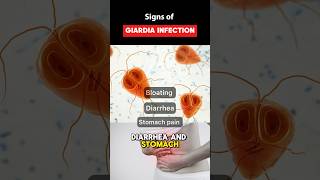 IBS Symptoms or Giardia Parasite Infection guthealth youtubeshorts shorts [upl. by Morrie591]