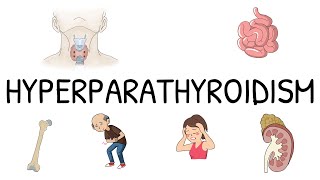 Hyperparathyroidism Primary Secondary and Tertiary  Simple and easy to understand [upl. by Thurman]