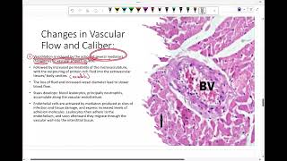 Intro to pathology tissue inflammation 2 [upl. by Rossie]