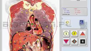 BIOPLASM NLS DEMO VIDEO 1 [upl. by Gwendolin199]