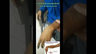 The Amazing Recovery from Wrist Paralysis [upl. by Sybila]