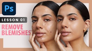 Remove Blemishes  Photoshop Retouching Course  Lesson 1 [upl. by Ponton115]