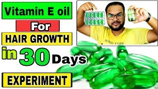 Evion 400 HAIR OIL HOW TO USE VITAMIN E CAPSULES FOR HAIR GROWTH amp HAIR FALL tannudada [upl. by Modesty]