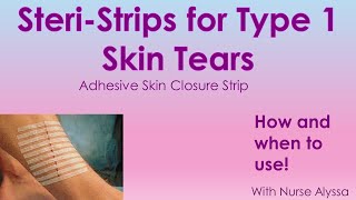 Steri Strips when and how to use [upl. by Ydissak733]