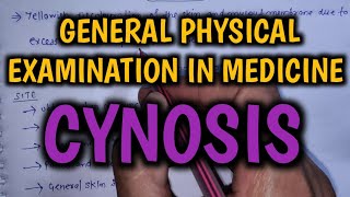 Cyanosis  General Physical Examination in Medicine  Final Year MBBS Practical Exam [upl. by Anaillil]