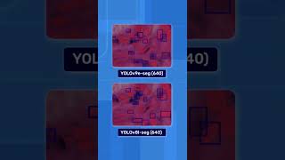 Instance Segmentation for Medical Imaging YOLOv8 vs YOLOv9 [upl. by Ramunni831]