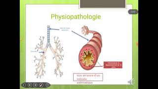 cours 05 pneumologie  asthme bronchique [upl. by Inalak]