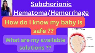 Subchorionic Hematoma My baby is safe or not Medications for Subchorionic hematoma [upl. by Donaldson472]