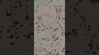 Gram positive and Negative Bacteria in Gram Staining of Culture Microscopy at various magnifications [upl. by Ressay]