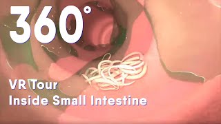 Small intestine with intestinal worms 360 VR Intestinal Parasites medical animation intestin 360 [upl. by Aihpos513]