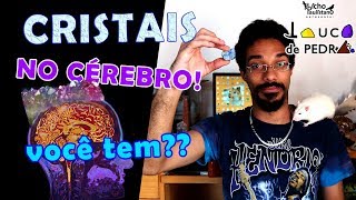 Você tem CRISTAIS no cérebro [upl. by Idnas]