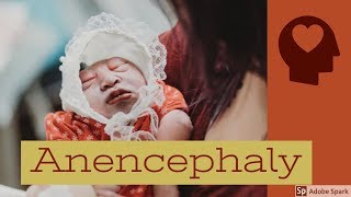 Babies Born Without A Brain  Anencephaly  Medical Grains Sol RN [upl. by Orvan]