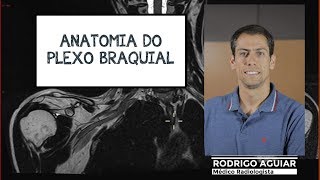 Anatomia do Plexo Braquial [upl. by Ariajay938]