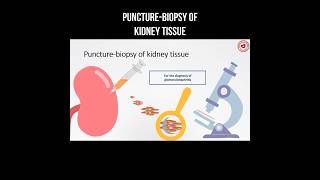 Puncture  biopsy of kidney tissue puncture kidneyhealth kidneydisease biopsy [upl. by Stutsman745]