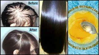 Powerful Remedy to Get Super Strong Hair  Stop Hair Fall in 1 Week  100 EFFECTIVE [upl. by Plato69]