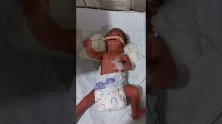 medicallife cutebaby newborncare nicu viral babycry 🥰🥰🥰 [upl. by Elleunamme]