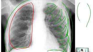 Dossier PAE  Pneumologie 04 [upl. by Bard]