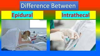 Difference between Epidural and Intrathecal [upl. by Nnylrefinnej]