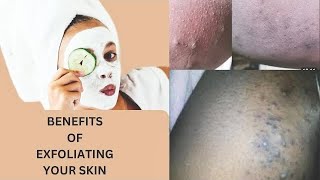 BENEFITS OF Exfoliating Your Face  What Face Scrubs DOES To Your Body [upl. by Koran]