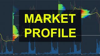 La PUISSANCE du Market Profile  Par quoi commencer avant de lutiliser [upl. by Llyrad]