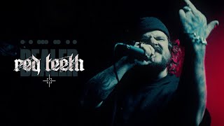 DEALER  RED TEETH Official Music Video [upl. by Notrub]