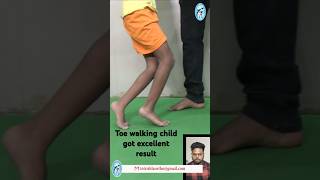 Cerebral Palsy child from Bangladesh Affected with jump knee gait got excellent recovery shorts [upl. by Gnues]