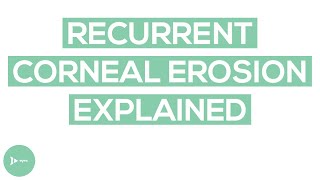 Recurrent Corneal Erosion RCE  RCE Causes and Treatment Options [upl. by Nore394]