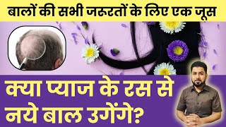 चैलेंज करतI हूँ बाल इतनी तेजी से बढ़ेंगे आप खुद हैरान हो जायेंगे I Onion Juice for Hair Growth [upl. by Razaile745]