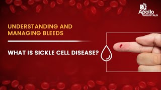 Apollo Hospitals  What is sickle cell disease  Dr Gaurav Kharya [upl. by Uriiah]