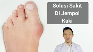 Solusi Sakit Di Jempol Kaki [upl. by Ihtraa]