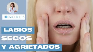 CÓMO MEJORAR LOS LABIOS SECOS Y AGRIETADOS [upl. by Worthington]