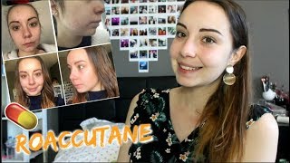 Bilan 6 mois avec ROACCUTANE résultats mon avis [upl. by Irtimed142]