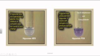 Group B Streptococci or Streptococcus Agalactia [upl. by Leoj]