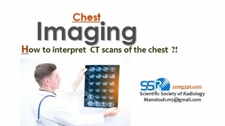 How to interpret CT scan of the chest  Prof Mamdouh Mahfouz [upl. by Ynogoham]