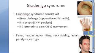 ENT 102 a GradeNigo Syndrome triad Petrositis Ear [upl. by Kassia841]