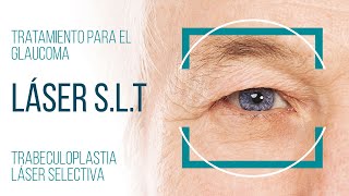 TRATAMIENTO DEL GLAUCOMA CON LASER SLT [upl. by Perrine]