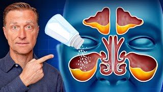 Rid Throat and Sinus Mucus with SALT [upl. by Obidiah]