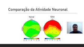 EletroEncefaloGrafia EEG de Superfície para reorientação do TDAH [upl. by Malliw293]