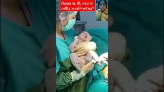 সিজার না কি নরমালে বেবি হলে বেশি কষ্ট হয়short vairalvideo vairalshort pregnancy babyshorts [upl. by Malcah]