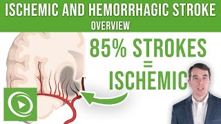 Overview of Ischemic and Hemorrhagic Stroke  Lecturio [upl. by Nimref184]