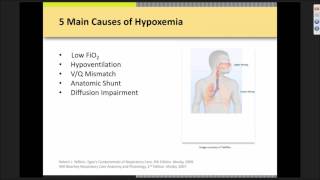 High Flow Nasal Cannula Therapy [upl. by Hanima]