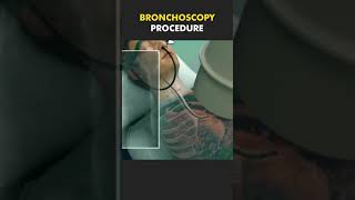 bronchoscopy procedure aiims medical neet [upl. by Alisa]